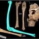Image for article titled Do These Battle-Scarred Remains Belong to Alexander the Great’s Father?